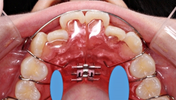 541eaa32ab17e56c3082b7438490465c_1750899615_6996.jpg