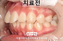 수술전