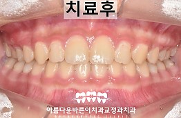 수술후