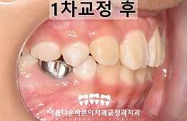 수술후