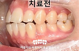 수술전