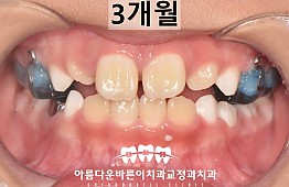 수술후