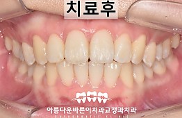 수술후