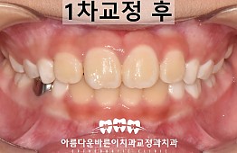 수술후