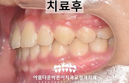 수술후