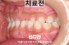 수술전