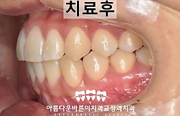 수술후