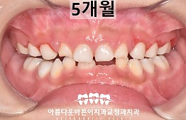 수술후