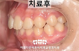 수술후