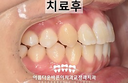 수술후