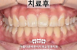 수술후