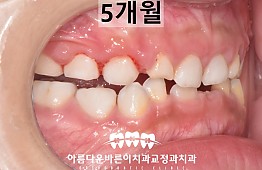 수술후