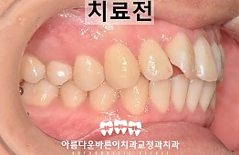 수술전