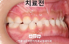 수술전