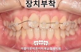 수술후