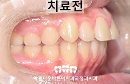 수술전