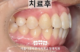 수술후