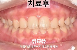 수술후