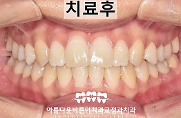 수술후