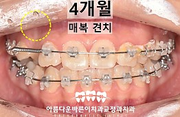 수술후
