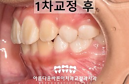 수술후