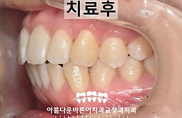 수술후