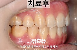 수술후