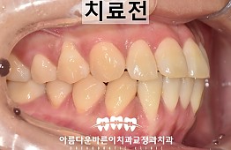 수술전