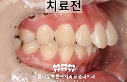 수술전