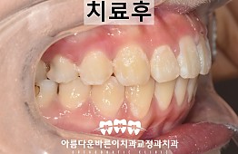 수술후