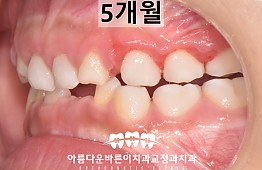 수술후