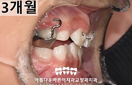 수술후