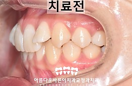 수술전