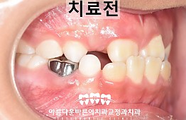 수술전