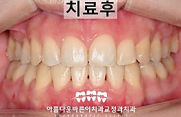 수술후