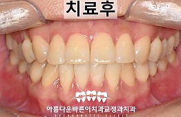 수술후