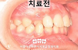 수술전