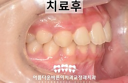 수술후