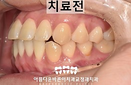 수술전