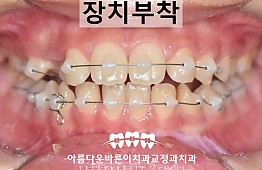 수술후