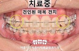수술후