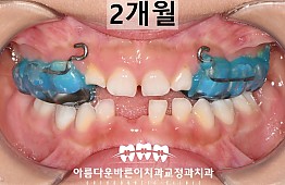 수술후