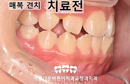 수술전
