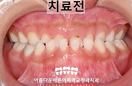 수술전