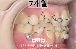 수술후