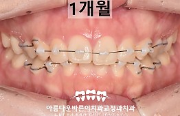 수술후