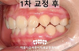 수술후