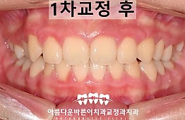 수술후