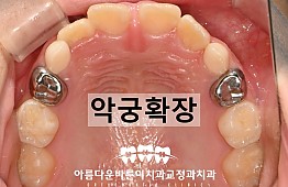 수술후