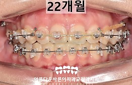 수술후